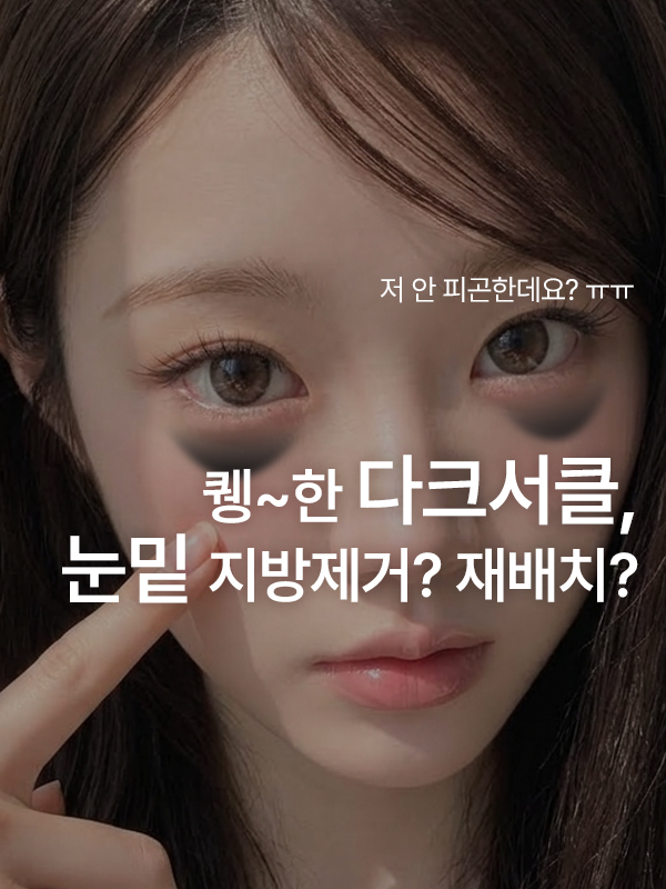 눈밑 지방 돌출과 꺼짐으로 그늘진 다크서클