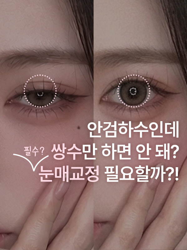 안검하수로 졸려 보이는 눈매