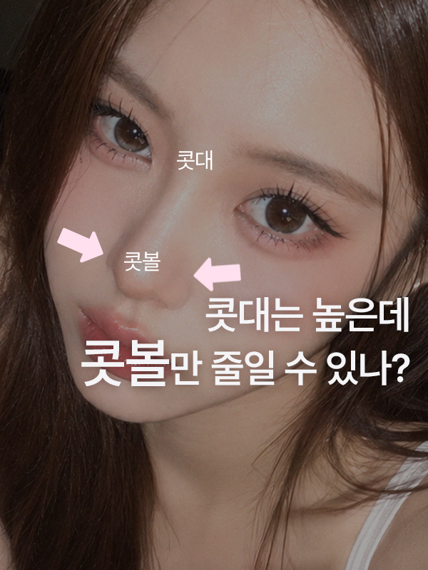 콧대는 높지만 콧볼이 넓어 보이는 코