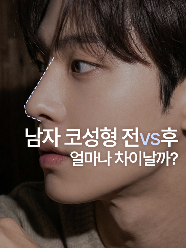 낮은 콧대와 뭉툭한 코끝의 남성 코