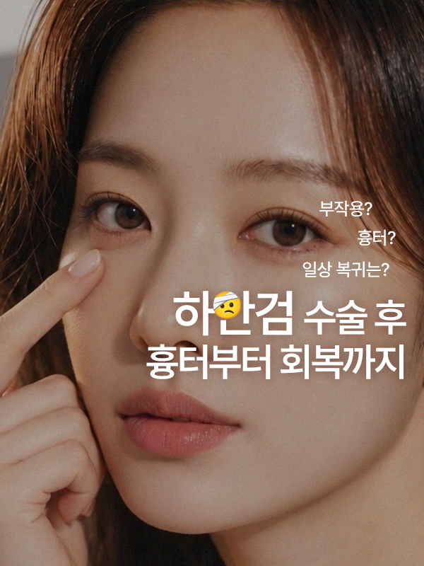 하안검 수술 후 회복 과정