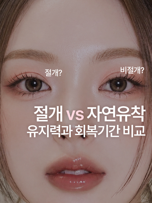 절개 쌍꺼풀과 자연유착 쌍꺼풀 비교