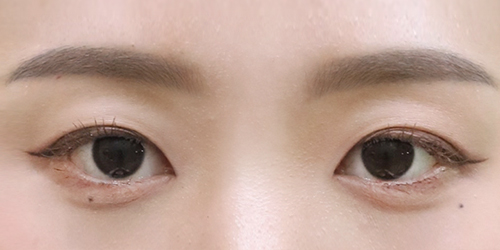 눈꺼풀이 얇고 지방이 적은 눈 예시
