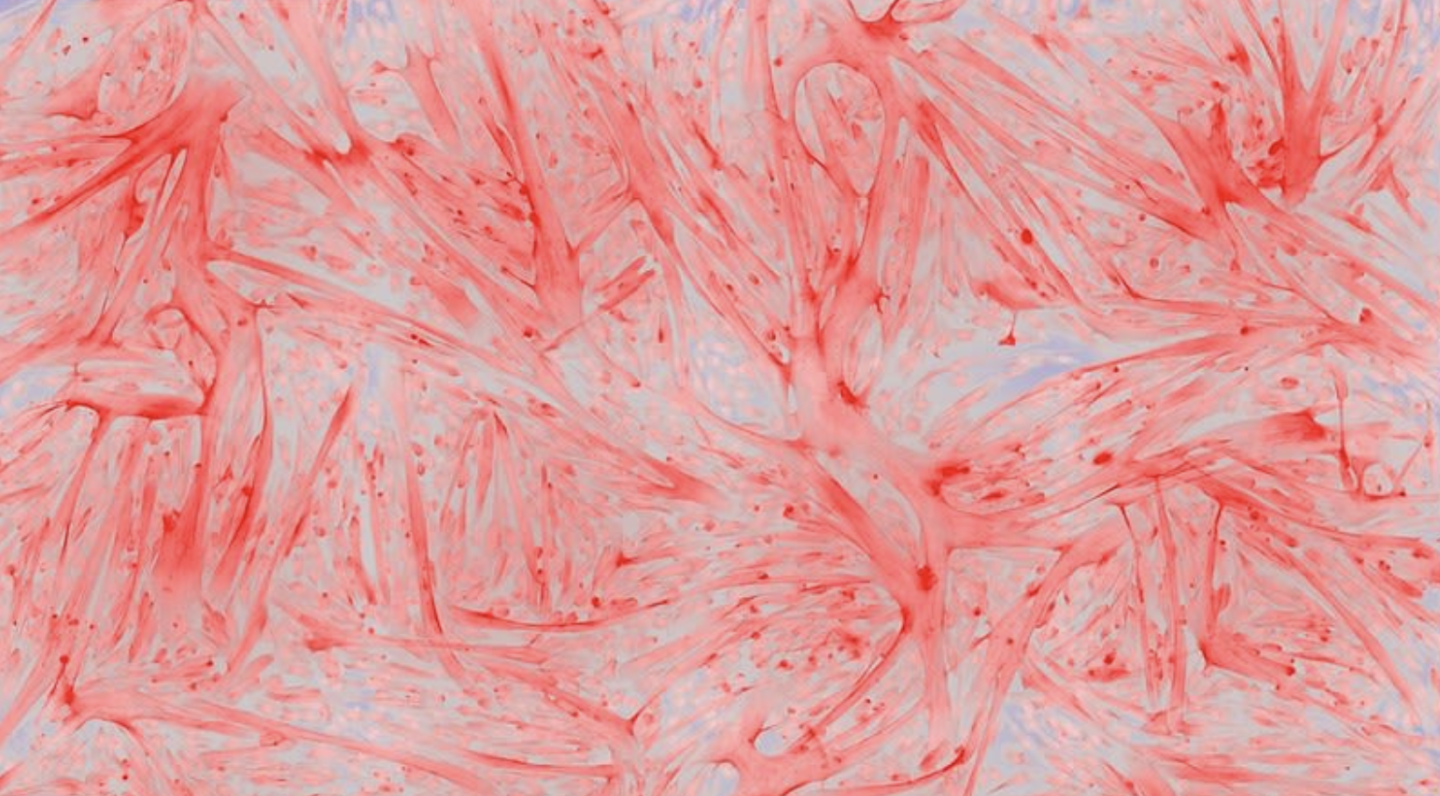 "Myoblasts are artists 4" by Wen Jin, University of Basel