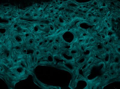 "To the bone" by Tatiana Kochetkova, University of Bern