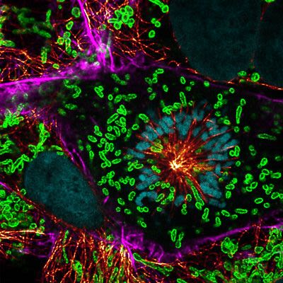 "The inner workings of a dividing cell" by Joana Delgado Martins, University of Zurich