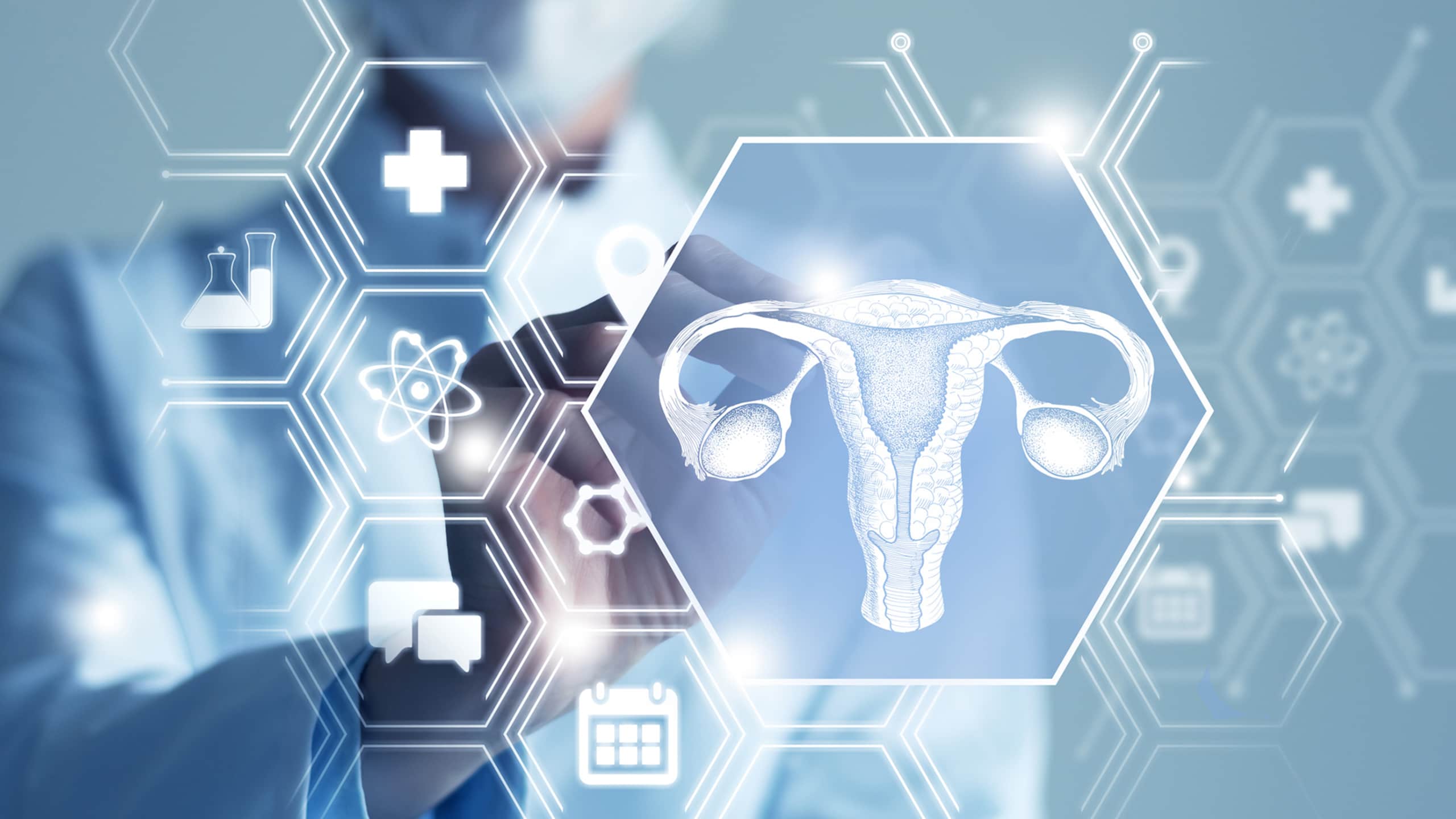 Managing and treating endometrial cancer