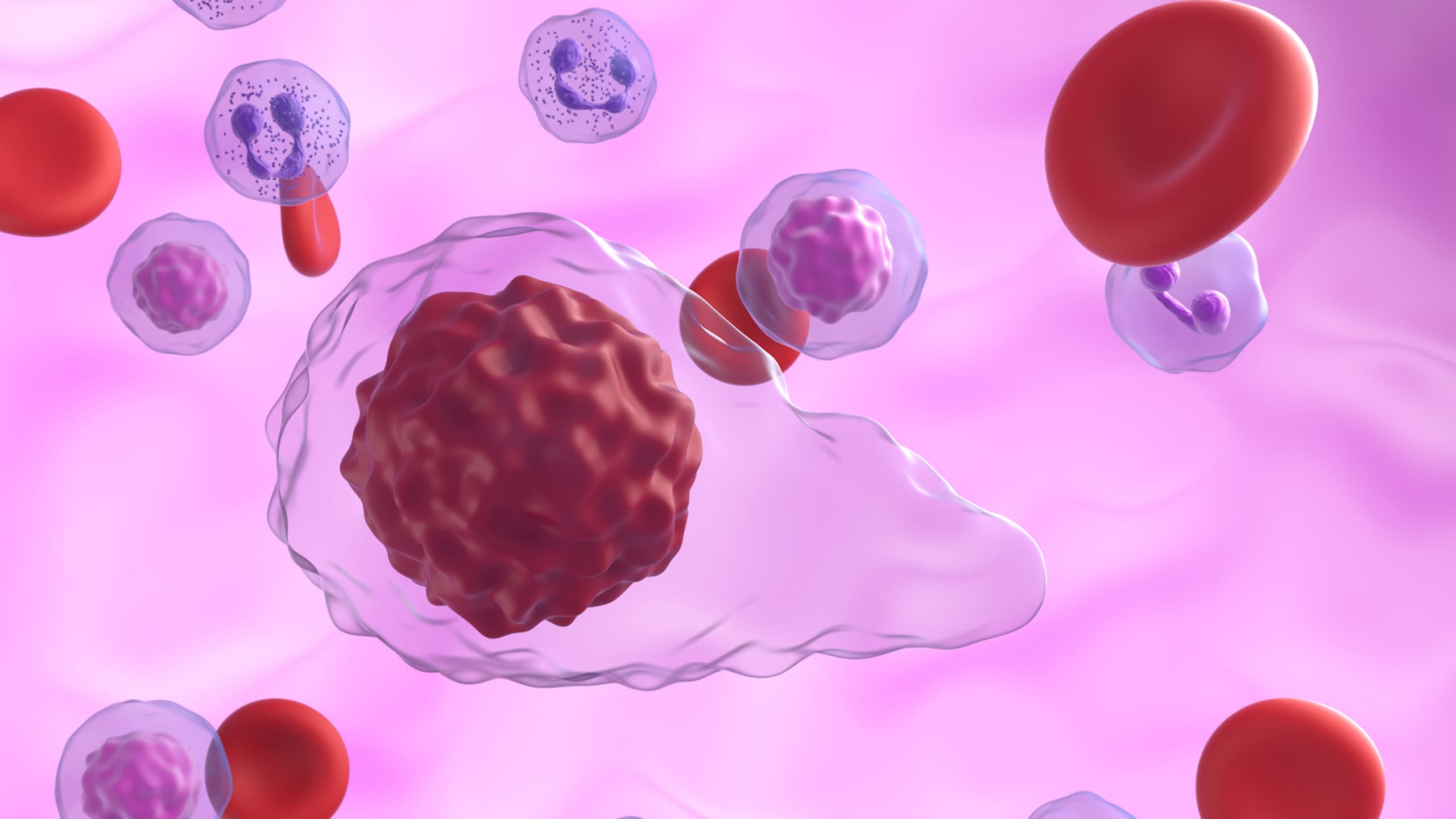Myelofibrosis rare disease roadmap