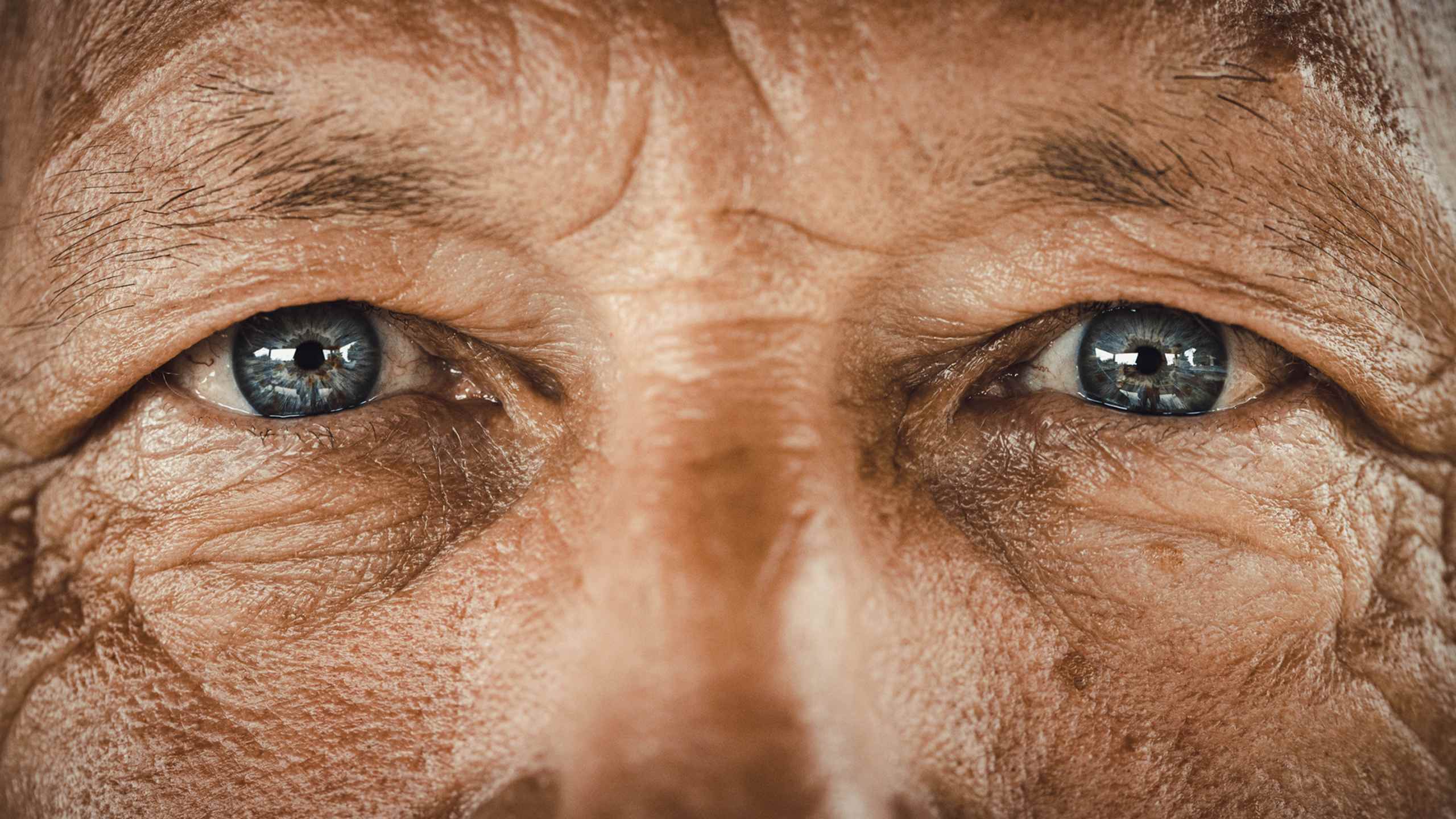 Living with thyroid eye disease (TED)