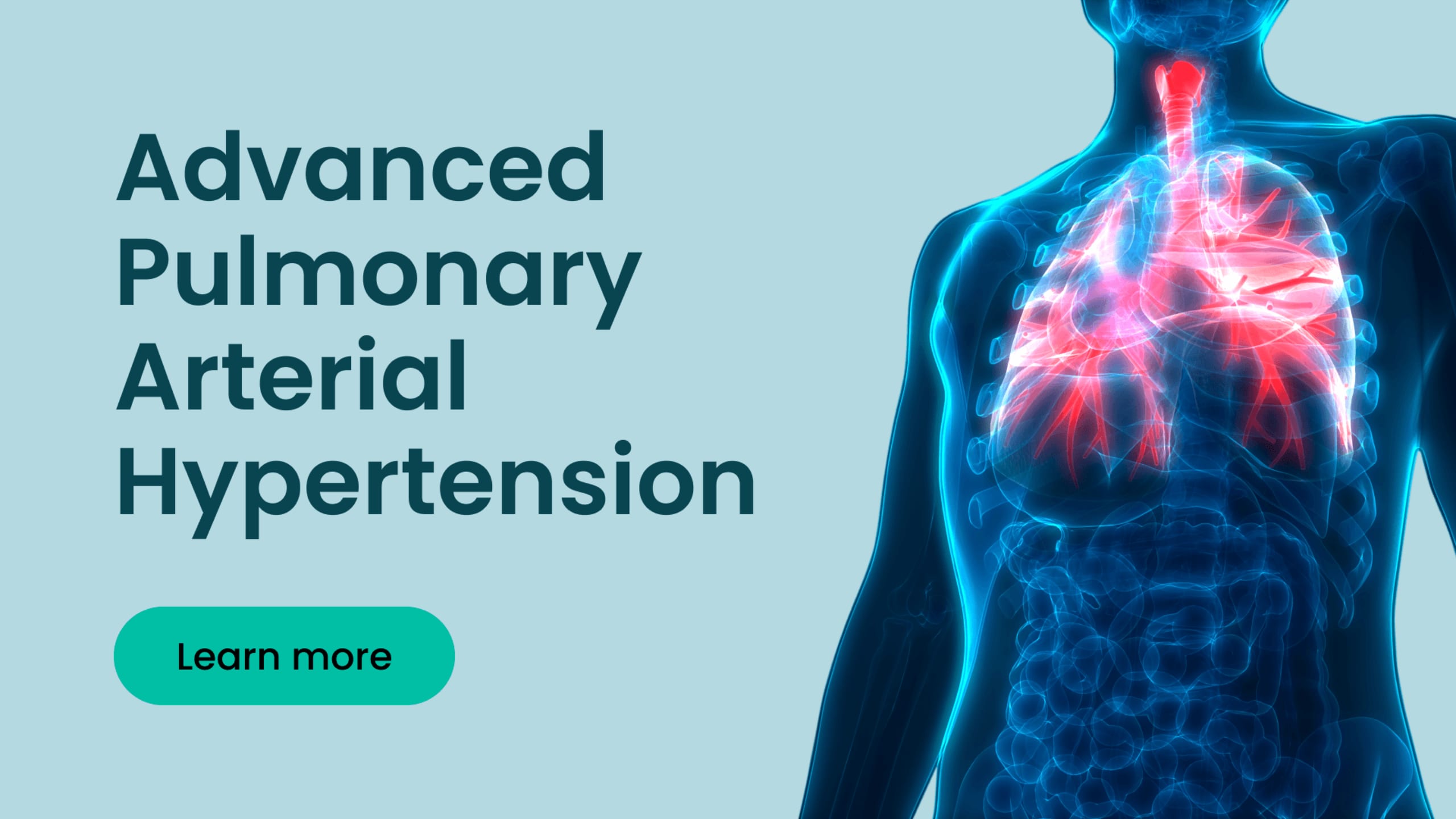 Advanced PAH resource center: treatment and management