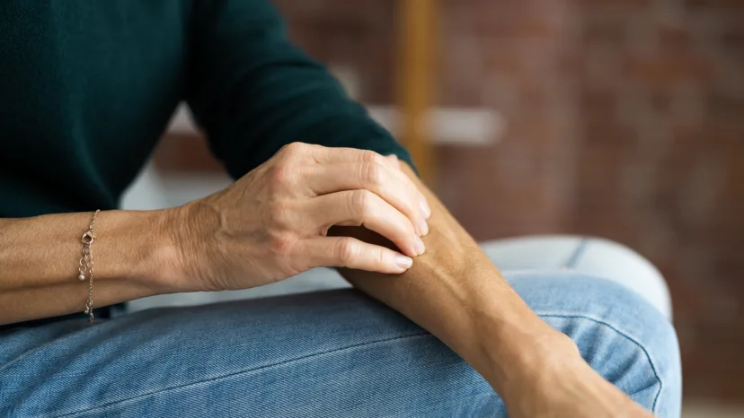 Woman itching the eczema on her arm.