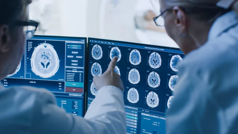 Doctor and Radiologist Discuss Diagnosis while Watching Procedure and Monitors Showing Brain Scans Results to diagnose stroke