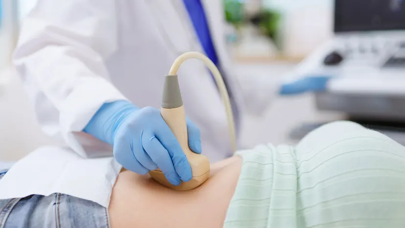 Woman lying on an exam table as a doctor performs an ultrasound to diagnose ovarian cancer