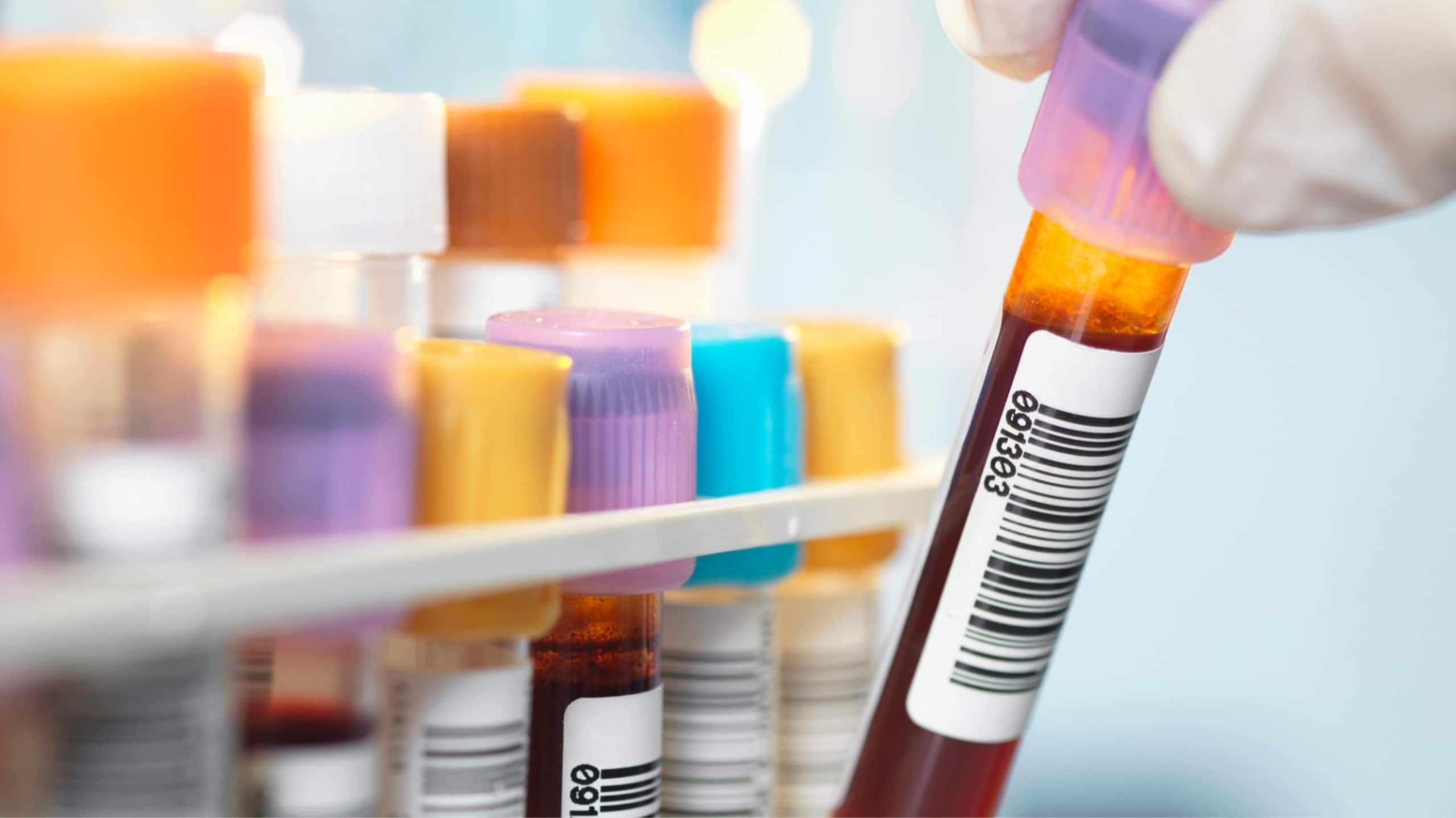 Severe hypertriglyceridemia resource center