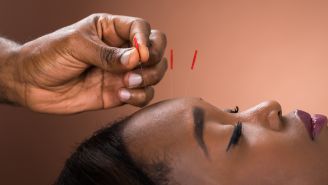What you need to know about acupuncture