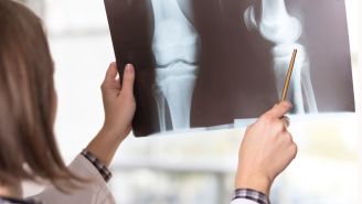 Rheumatoid arthritis tests and exams