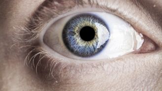 Looking for stroke risks in eyeball photos