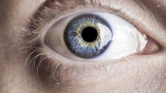 Looking for Stroke Risks in Eyeball Photos 