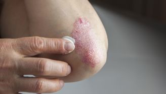 All-access guide to five common skin conditions