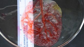 Spinach leaves used to help grow human heart tissue