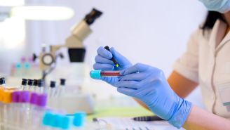 How a blood test may help rheumatoid arthritis patients