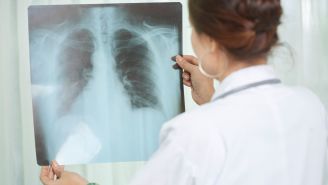 What you need to know about TB