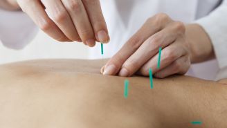 Can Acupuncture Help Ease Your Chronic Pain?