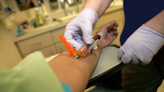 Managing HIV while also managing hep C