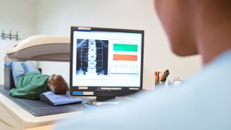 Should You Be Screened for Osteoporosis?