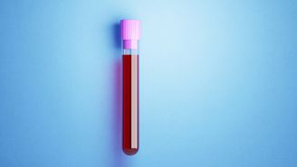 A guide to understanding your iron levels