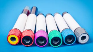 Why psoriasis is more than a skin disorder