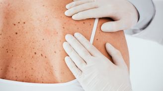 Regular Doctor Visits May Help You Survive Skin Cancer