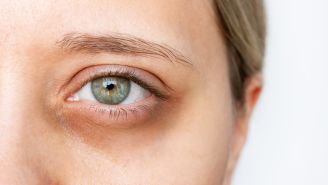 Should You Take Supplements for Your Eyes?