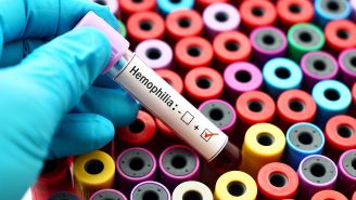 What are the different types of hemophilia?
