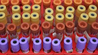 Biomarker testing for non-small cell lung cancer