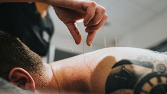 What to know about acupuncture