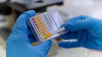 C3 glomerulopathy: Understanding proteinuria