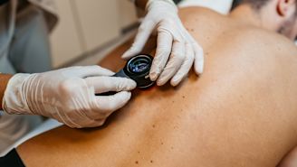 Melanoma diagnosis more deadly for men than women