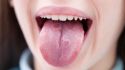 What your tongue reveals about your health