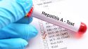 What you need to know about hepatitis A