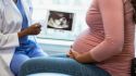 What Is Preeclampsia—and How Is It Treated?