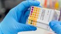 Understanding proteinuria in FSGS