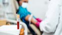 Understanding eosinophils and eosinophilic asthma
