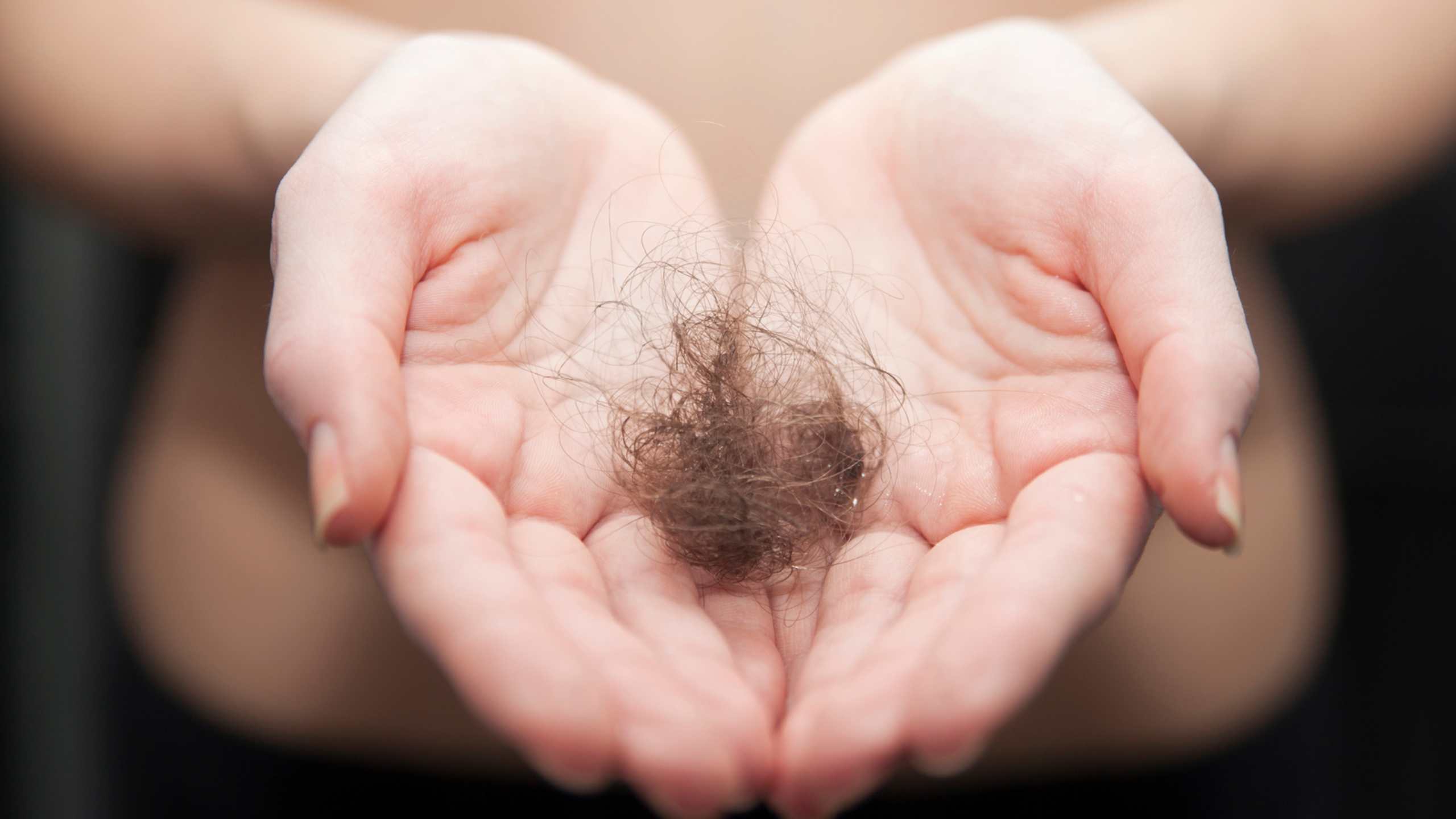 Shedding