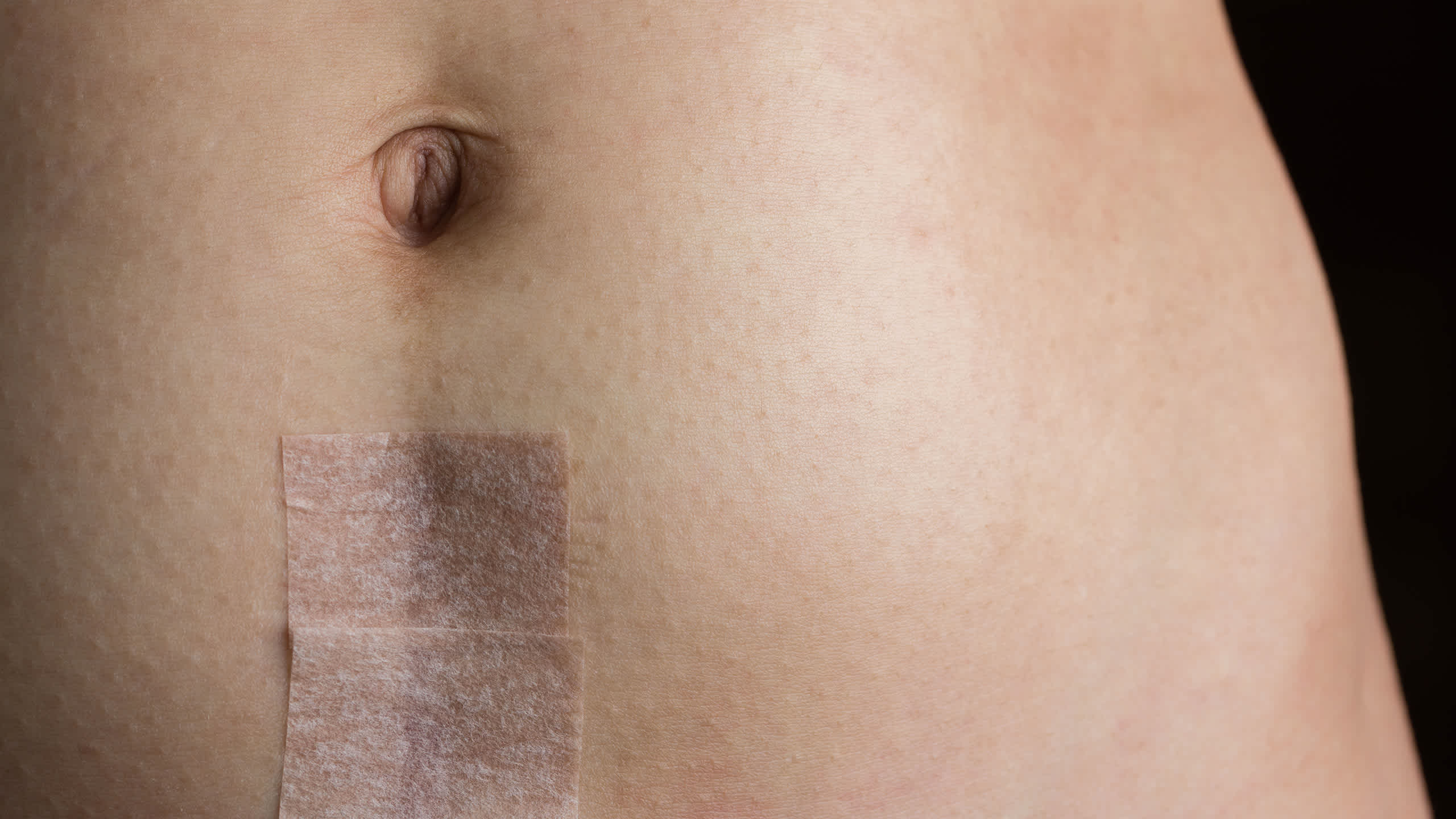 The type of scar will depend on your surgery