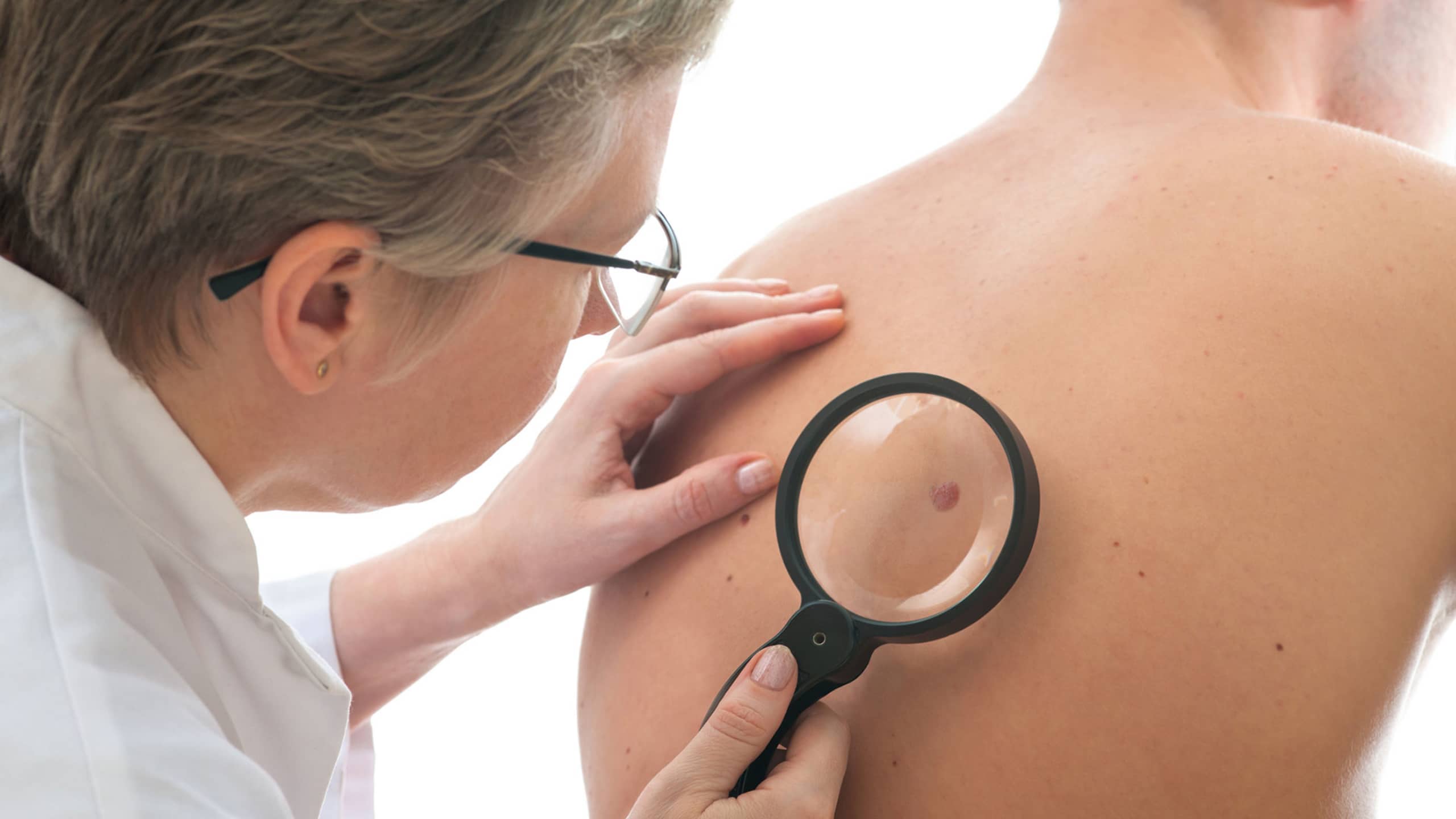 Skin exam