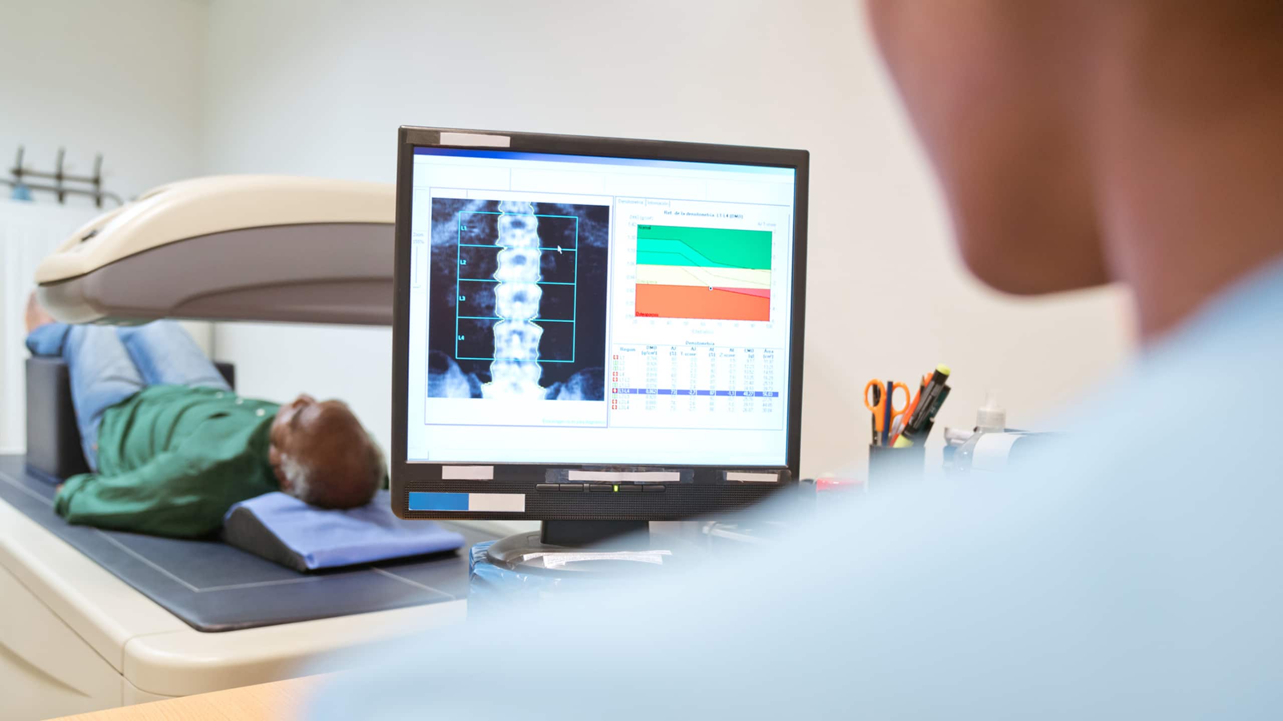 Bone density test