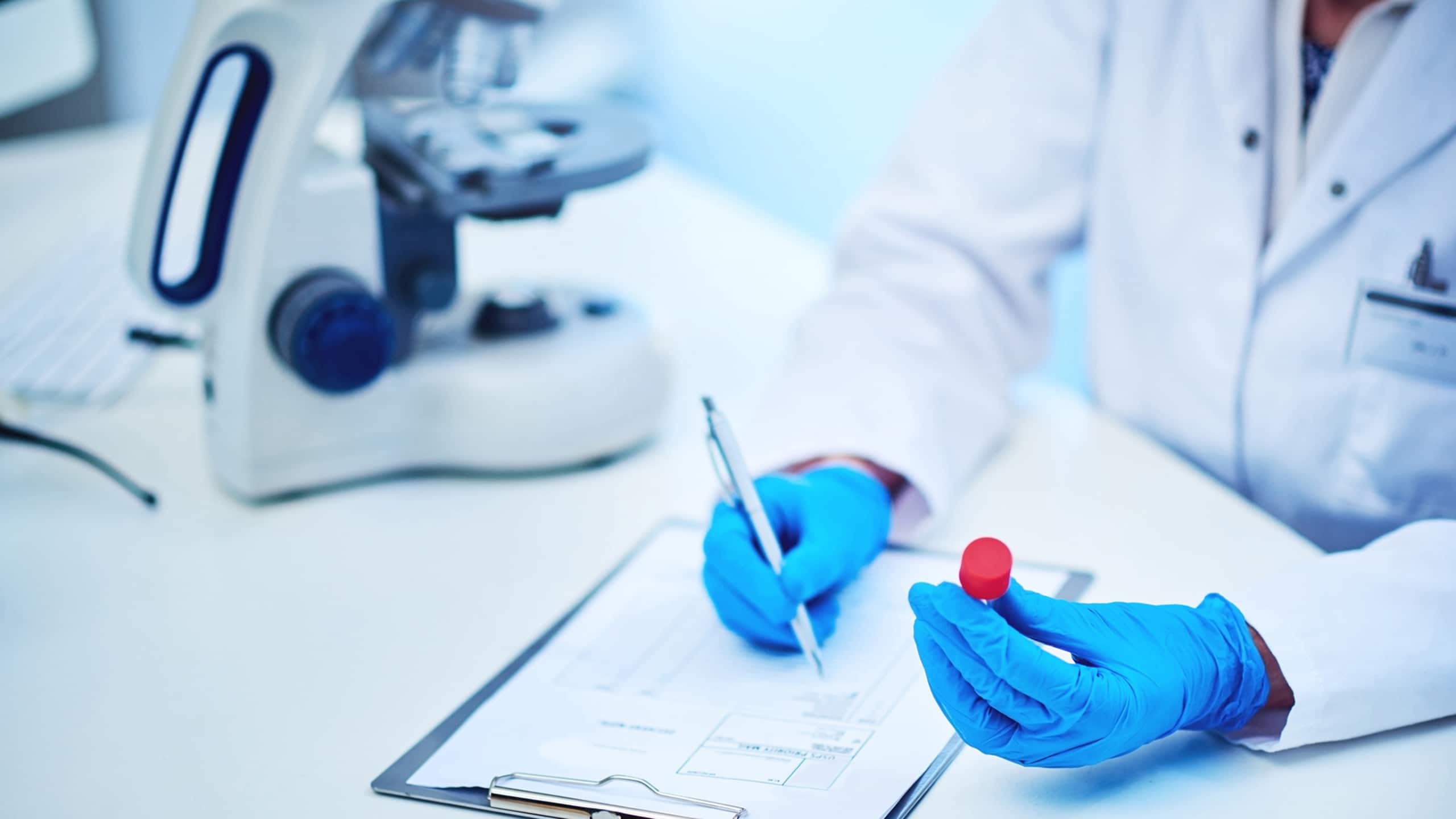 Cholesterol tests