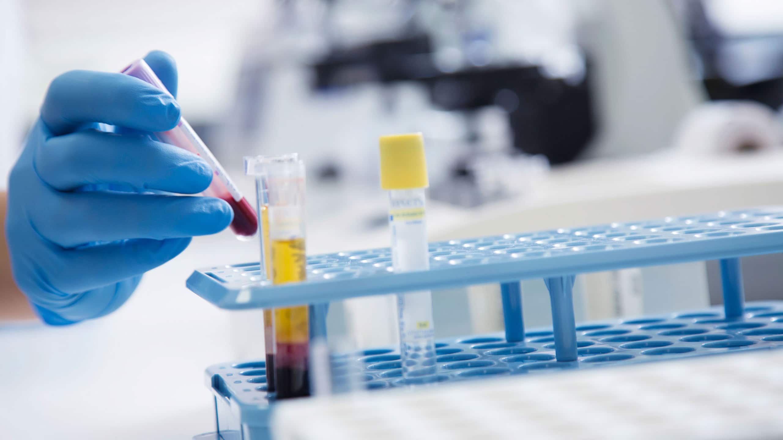 Cholesterol screenings