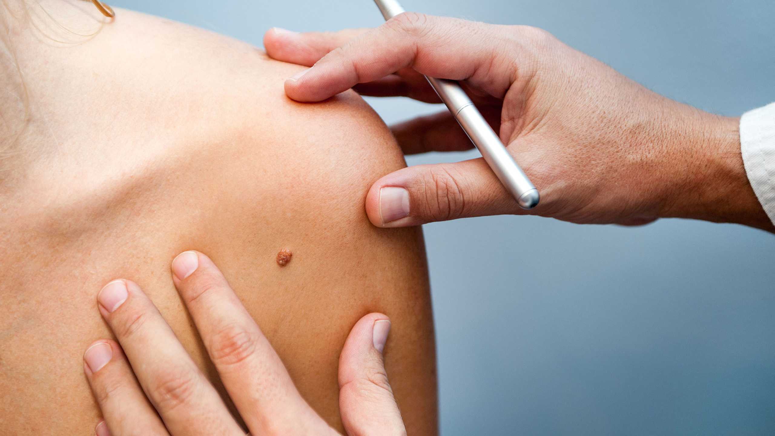 Skin exams